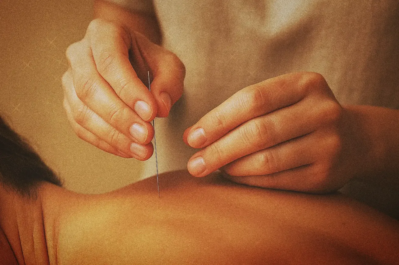 Dry Needling session in Ibiza